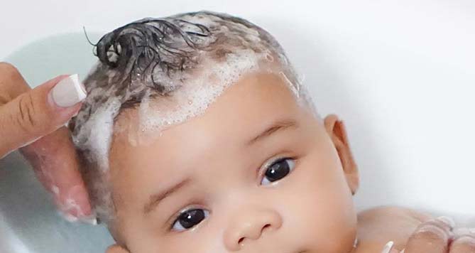 楊浩康(Yeung Ho Hong)醫生講解嬰兒的脂漏性皮膚炎